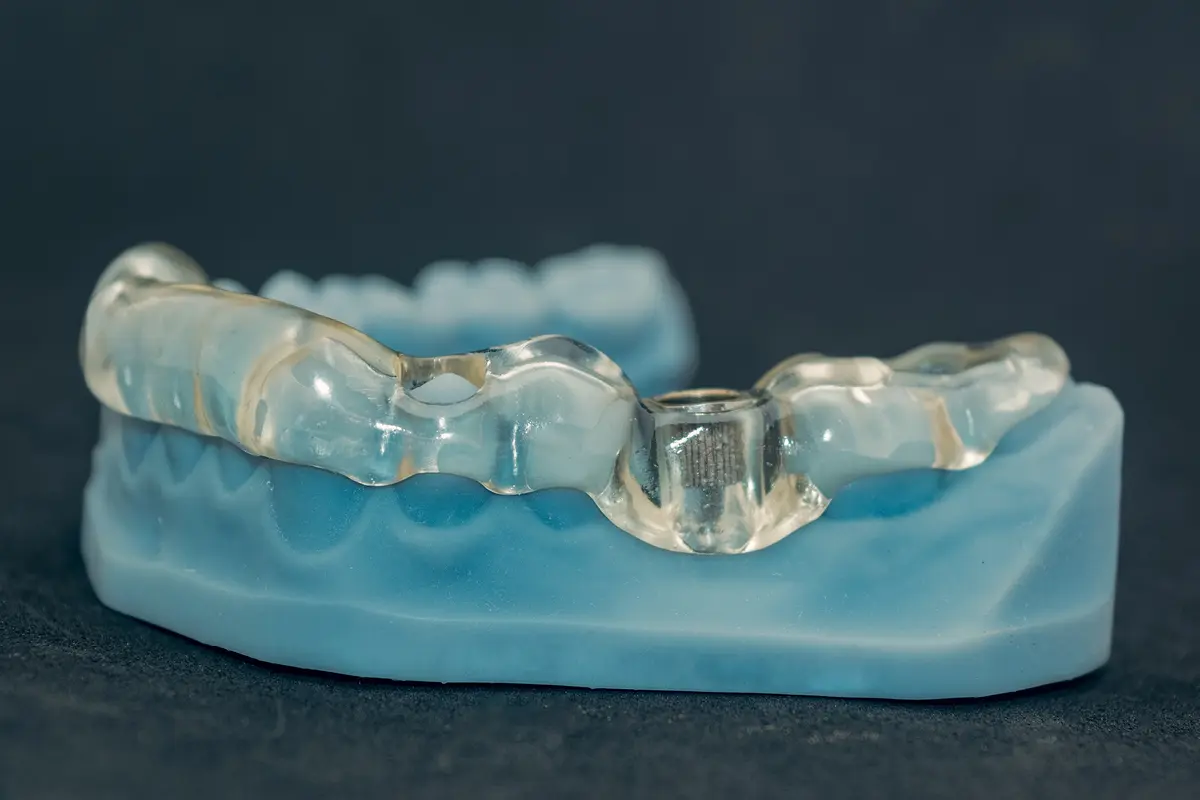 chirurgia-implantare-guidata